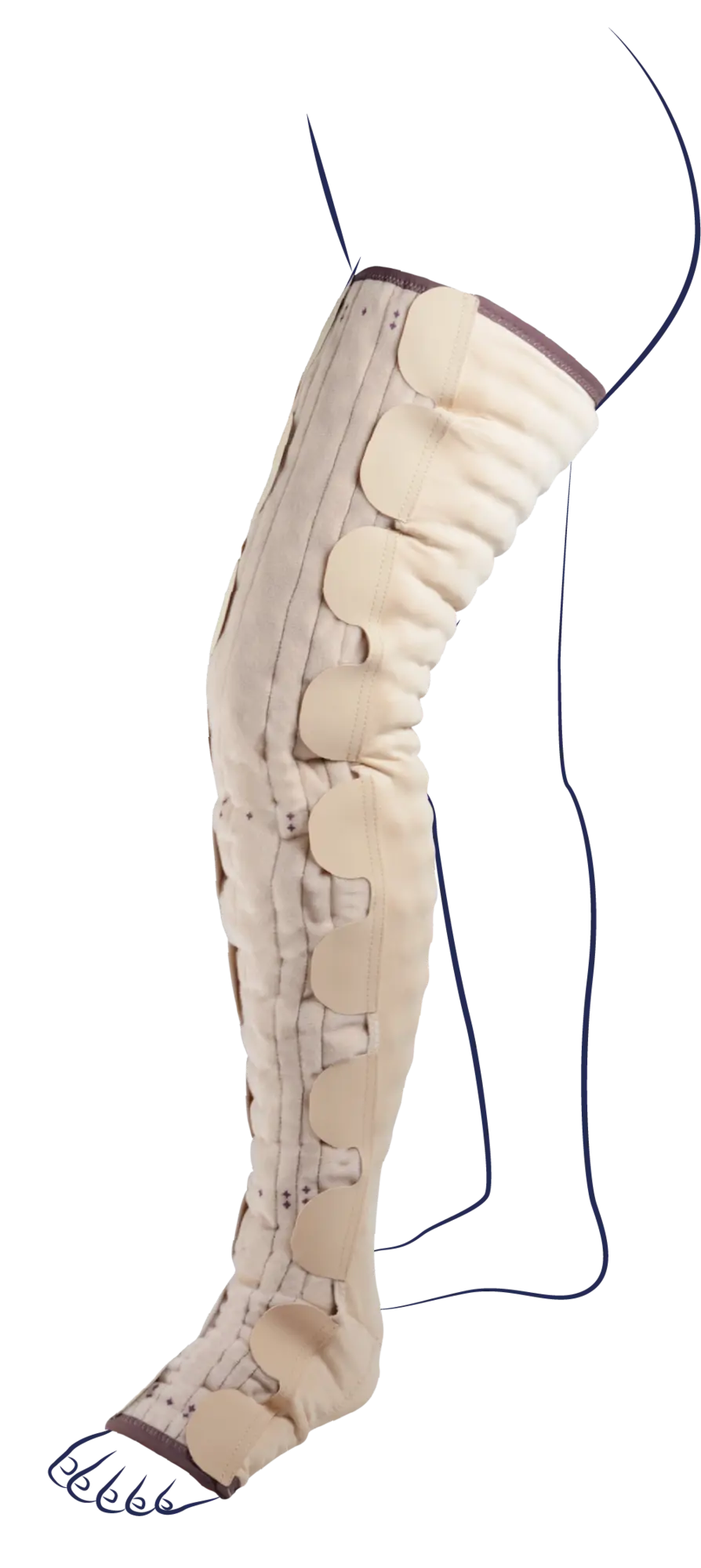 Mobiderm® Autofit Thigh High Stocking